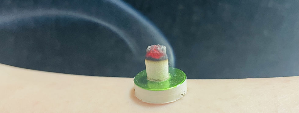 Acupuncture treatment with moxibustion, smoke rising from a burning moxa stick.