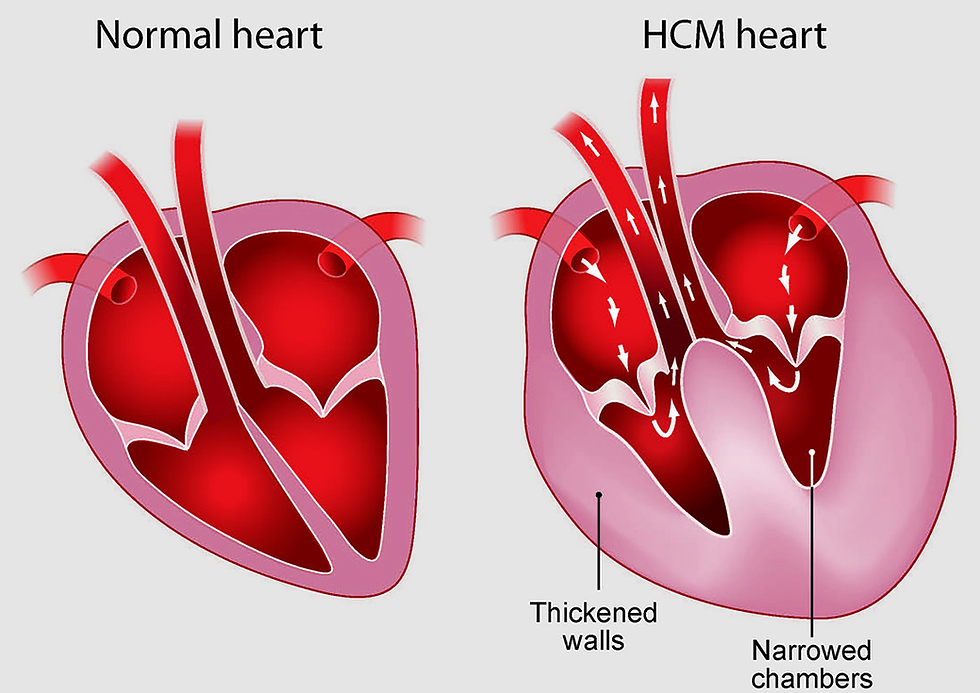 HCM