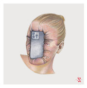 LOVA, Smartphone, Vakuum