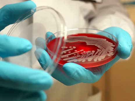 Superbugs Threaten Global Health: a Looming Crisis by 2050