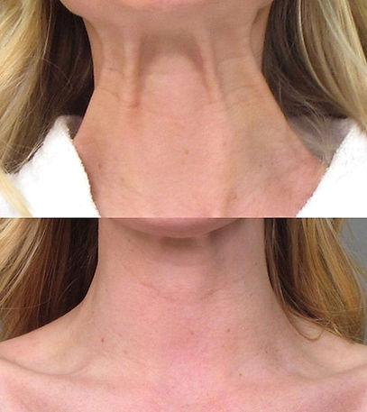 neck band_edited.jpg