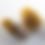 Thumbnail: Kidney stones 