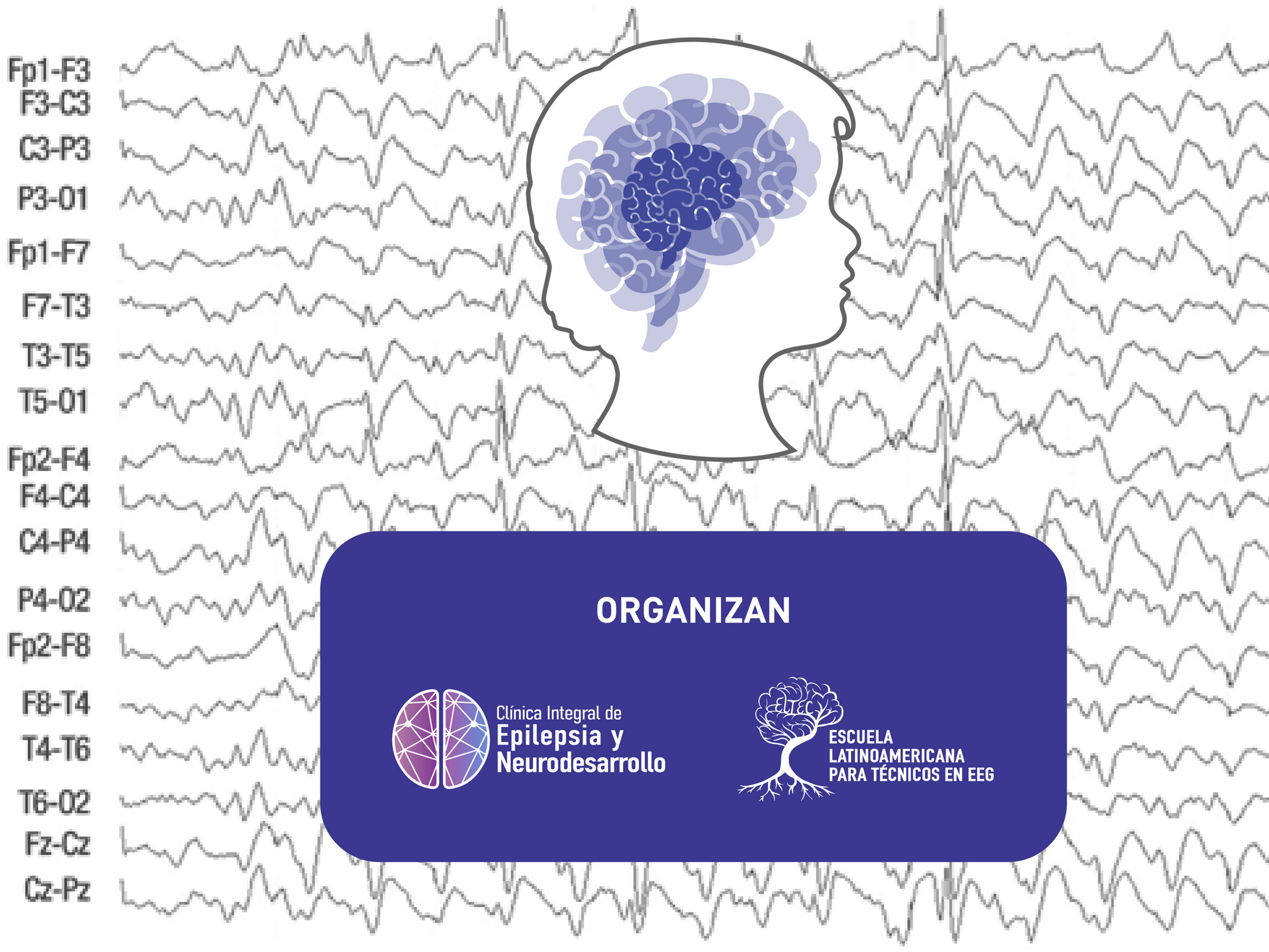 Diplomado en Electroencefalografía Pediátrica