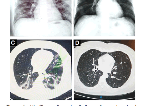effects of ivermectin azithromycin cholecalciferol combined therapy on covid19 infected patients...