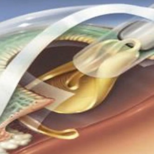 infinitevisionoptics-portfolio-pix-940x475.jpg