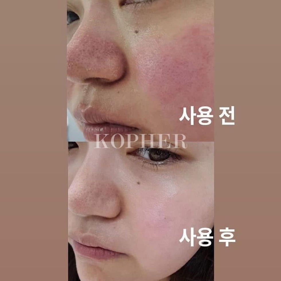 ภาพขนาดย่อ: KOPHER - Curepair Melder SOS System (1.5ml x 20ea - 30ml)