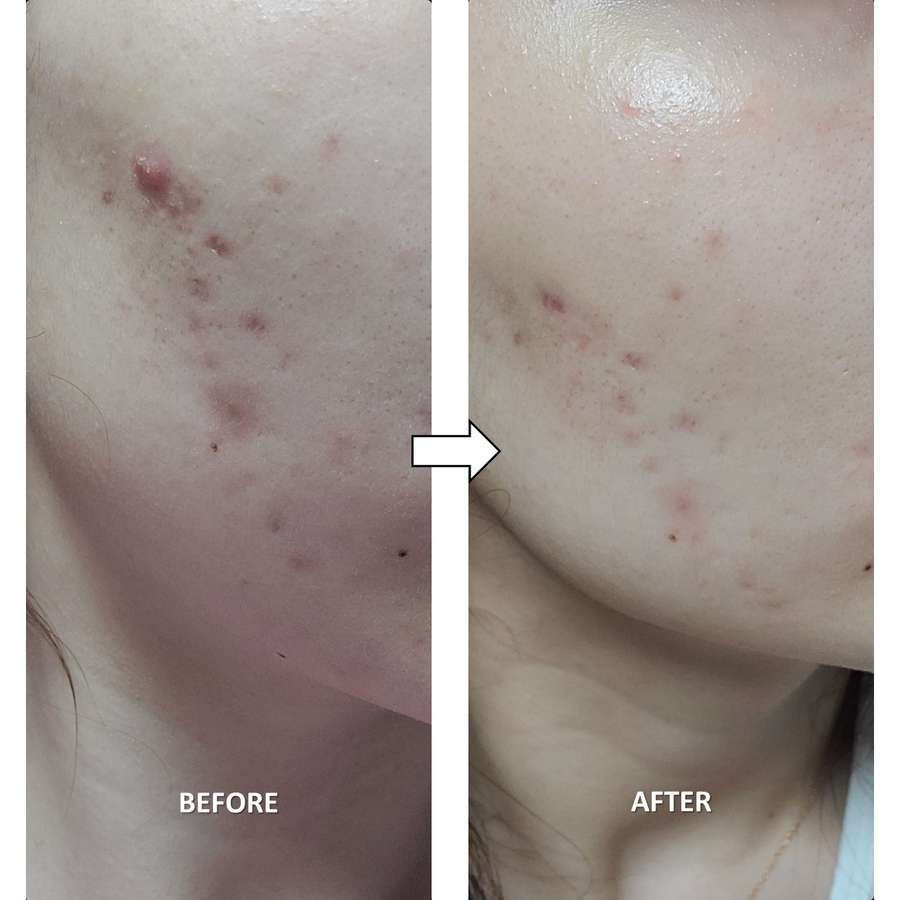 Miniatura: Bravity - Derma Stem-cell 35 Program Ampoule