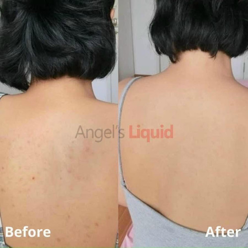 angel's liquid glutathione body mist Angel's Liquid Glutathione Niacinamide Arbutin Cooling Fresh Deodorant –  Amore Cosmetics main image 0