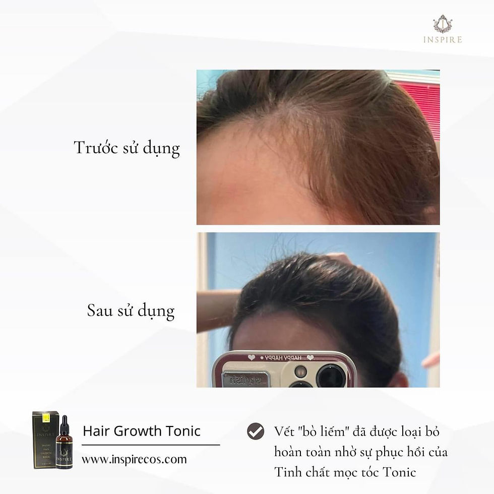 Thumbnail: INSPIRE HAIR GROWTH TONIC - 50ml