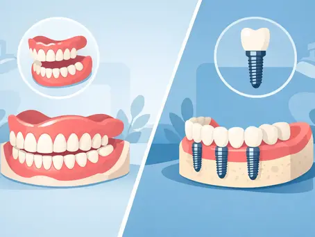 Full Dentures Versus Implants: Which Fits?
