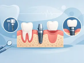 Single Tooth Implant Procedure Explained