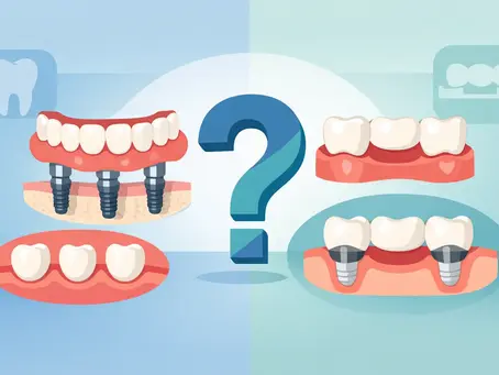 Implant Dentures or Bridges: Which Fits You?