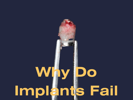 Failed implant in ipoh