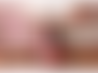 Smile Makeover in Ipoh: A New Smile for a New Beginning on 人日 (Everyone’s Birthday)