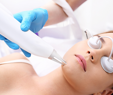 LASER FRAZIONATO CICATRICI.png