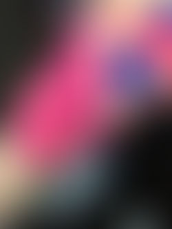 The what, why and how of Kinesiotaping!