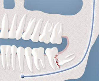 Oral surgery in Robbinsville New Jersey