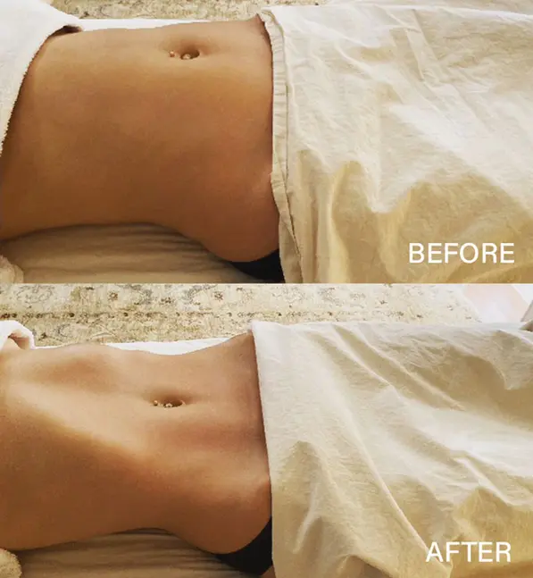 Before and after photo of a woman's midsection with the text