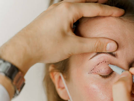 Is Eyelid Surgery Suitable for Men and Women?