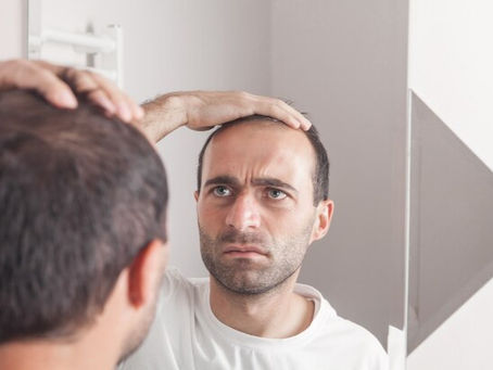 How Soon Will Hair Grow After Transplant?