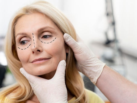 Blepharoplasty Surgery: Restoring Your Natural Beauty