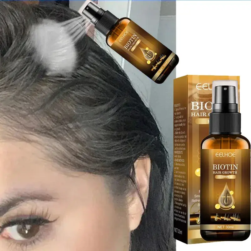 Biotin Hair Growth Spray Treatment for Men & Women