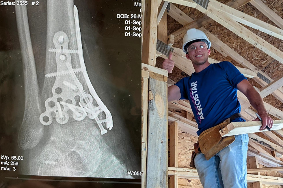 Side by side of an x-ray of his severely injured foot and him building a home at VCP
