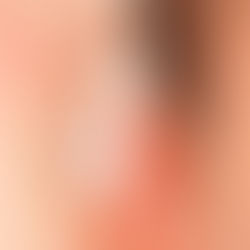 Blindgossip: cosa non si fa per...