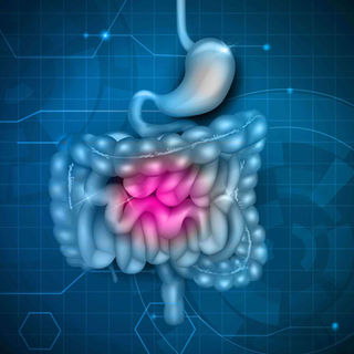 Inflammatory Bowel Disease