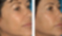 AntiAging-005_B&A.jpg