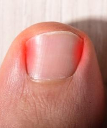 diabetic footcare
