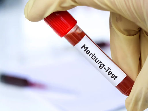 Murieron ocho personas por posible brote de la enfermedad del virus de Marburgo en Tanzania