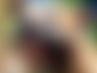 Córdoba: una mujer fue atacada por un pitbull y evalúan amputarle los dos brazos