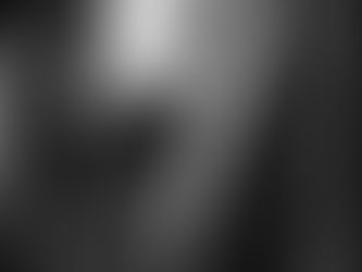 Sings of Aortic Dissection to help diagnosis before a CT scan.