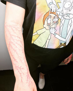 Even Rick and Morty can't believe this lightning scar!!