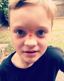 This little fella let me practise my broken nose on him today, all so that he could go and scare pap