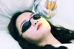 Cautery And  Pimple Injection
