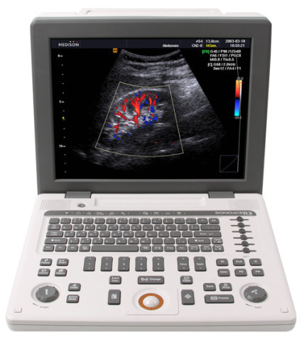 Samsung Medison SonoAce R3 Portable Ultrasound hi-techelectromed