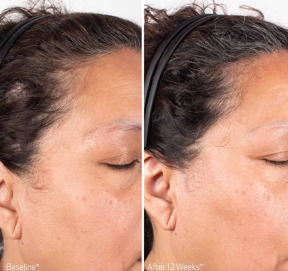 Thumbnail: OBAGI NUCIL Scalp Serum