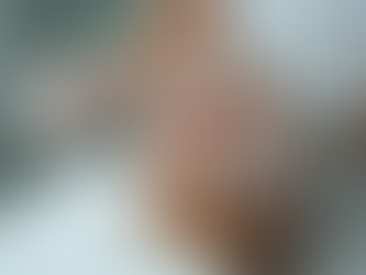 Discover the Magic of Chemical Peels in Atlanta