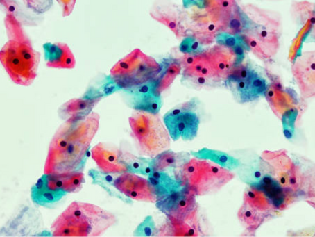 Pap Smears and Trauma: How the Medical System Leaves Sexual Violence Survivors Vulnerable to Cervical Cancer