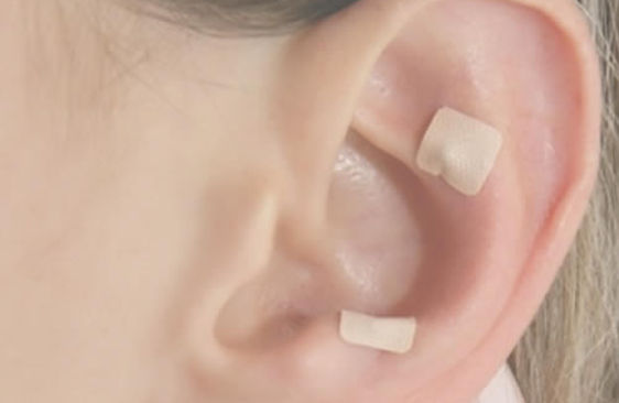 Auriculoterapia-e-Auriculopuntura.jpg