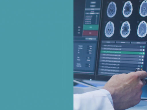 Craneotomía (Hematoma Subdural Crónico)