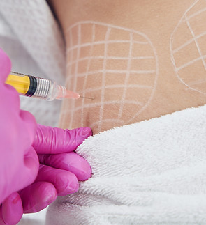 Dermatologist performing non invasive fat reduction procedure in beauty center.jpg