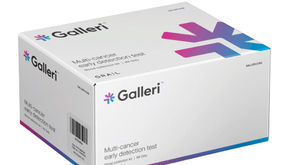 Multi-Cancer Early Detection Screening Test