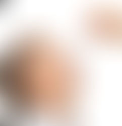 Inmunoterapia SL: Cuando debemos posponer su aplicación?