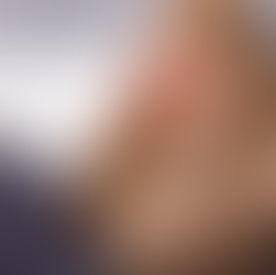 Is Your Morning Headache Actually a Jaw Issue? The Secret to TMJ Relief in Plano.