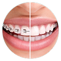 Dentistry Orthodontics Dental braces.png