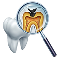 Tooth decay Dentistry Dental.png