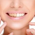 whitening.png